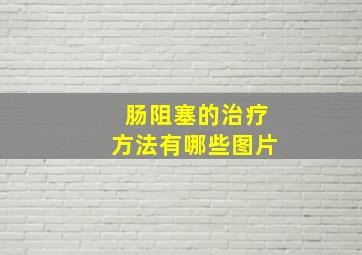 肠阻塞的治疗方法有哪些图片