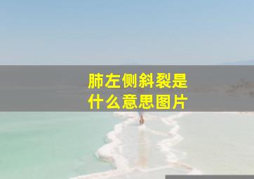 肺左侧斜裂是什么意思图片