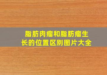 脂肪肉瘤和脂肪瘤生长的位置区别图片大全