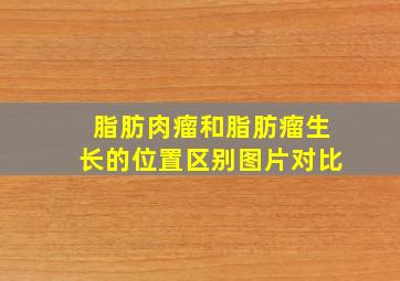 脂肪肉瘤和脂肪瘤生长的位置区别图片对比