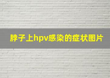 脖子上hpv感染的症状图片