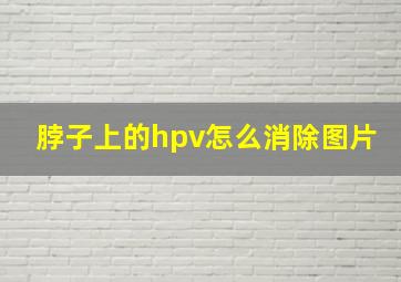 脖子上的hpv怎么消除图片