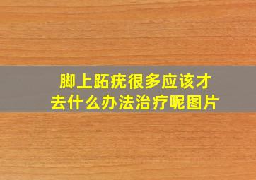 脚上跖疣很多应该才去什么办法治疗呢图片