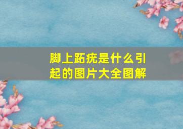 脚上跖疣是什么引起的图片大全图解