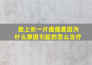 脸上长一片痘痘是因为什么原因引起的怎么治疗