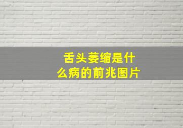 舌头萎缩是什么病的前兆图片