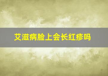 艾滋病脸上会长红疹吗