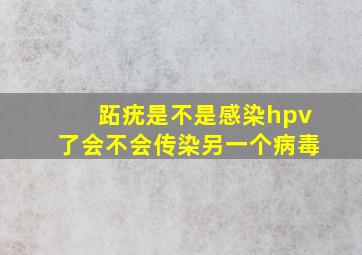 跖疣是不是感染hpv了会不会传染另一个病毒