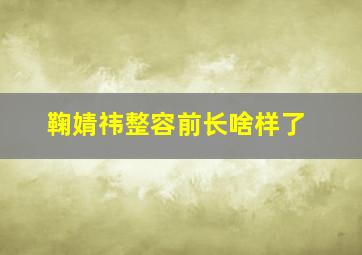 鞠婧祎整容前长啥样了