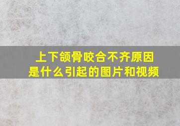 上下颌骨咬合不齐原因是什么引起的图片和视频