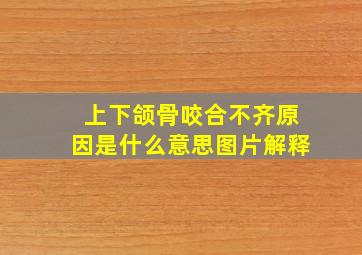 上下颌骨咬合不齐原因是什么意思图片解释