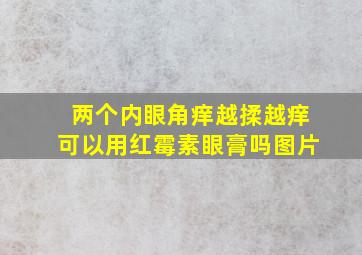 两个内眼角痒越揉越痒可以用红霉素眼膏吗图片