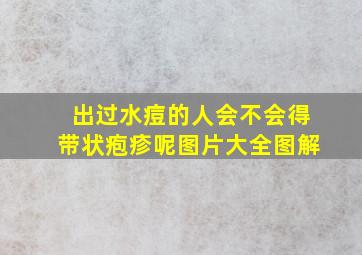 出过水痘的人会不会得带状疱疹呢图片大全图解