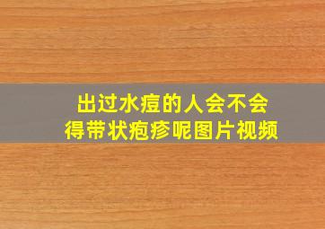 出过水痘的人会不会得带状疱疹呢图片视频