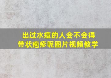 出过水痘的人会不会得带状疱疹呢图片视频教学