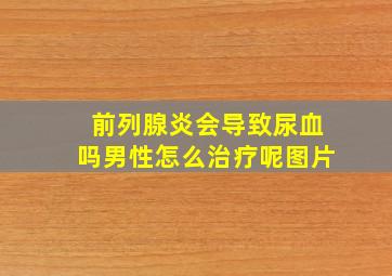 前列腺炎会导致尿血吗男性怎么治疗呢图片