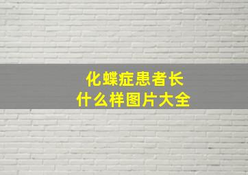 化蝶症患者长什么样图片大全