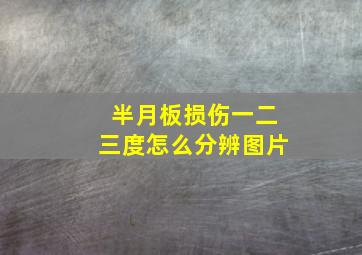 半月板损伤一二三度怎么分辨图片