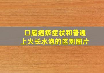 口唇疱疹症状和普通上火长水泡的区别图片