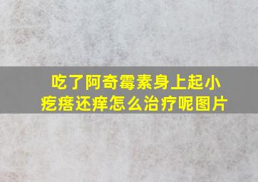 吃了阿奇霉素身上起小疙瘩还痒怎么治疗呢图片