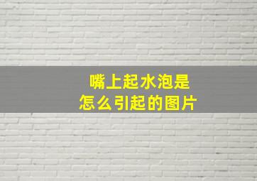 嘴上起水泡是怎么引起的图片