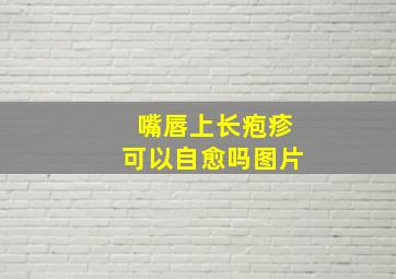 嘴唇上长疱疹可以自愈吗图片