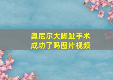 奥尼尔大脚趾手术成功了吗图片视频