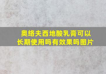 奥络夫西地酸乳膏可以长期使用吗有效果吗图片