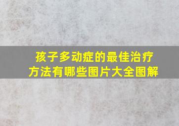 孩子多动症的最佳治疗方法有哪些图片大全图解