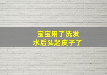 宝宝用了洗发水后头起皮子了