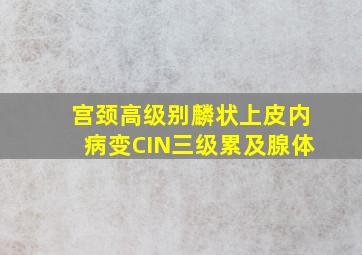 宫颈高级别麟状上皮内病变CIN三级累及腺体