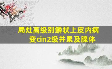 局灶高级别鳞状上皮内病变cin2级并累及腺体