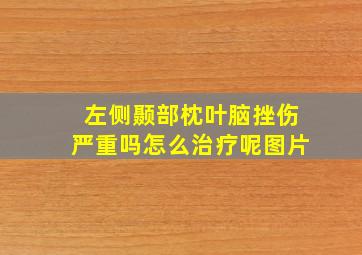 左侧颞部枕叶脑挫伤严重吗怎么治疗呢图片