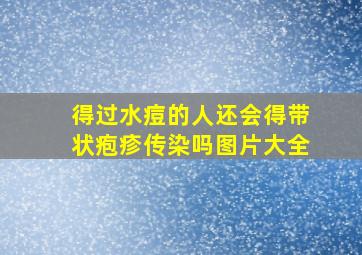 得过水痘的人还会得带状疱疹传染吗图片大全