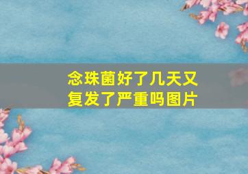 念珠菌好了几天又复发了严重吗图片