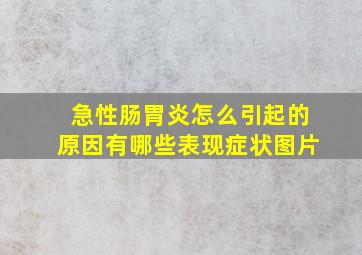 急性肠胃炎怎么引起的原因有哪些表现症状图片