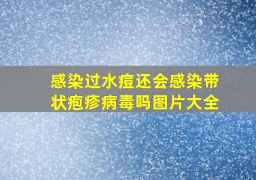 感染过水痘还会感染带状疱疹病毒吗图片大全