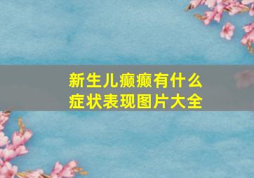 新生儿癫癫有什么症状表现图片大全