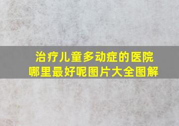 治疗儿童多动症的医院哪里最好呢图片大全图解