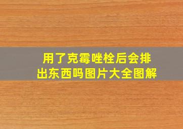 用了克霉唑栓后会排出东西吗图片大全图解