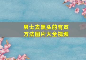 男士去黑头的有效方法图片大全视频