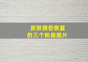 皮肤损伤恢复的三个阶段图片