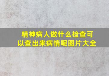 精神病人做什么检查可以查出来病情呢图片大全