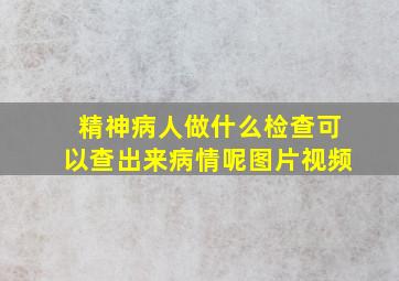 精神病人做什么检查可以查出来病情呢图片视频