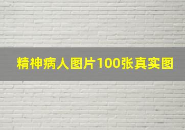 精神病人图片100张真实图