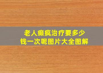 老人癫疯治疗要多少钱一次呢图片大全图解