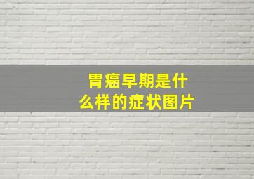 胃癌早期是什么样的症状图片