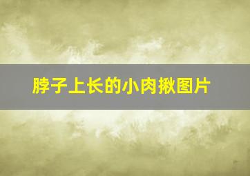 脖子上长的小肉揪图片