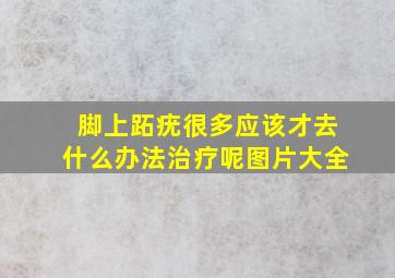 脚上跖疣很多应该才去什么办法治疗呢图片大全