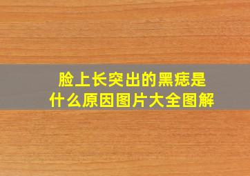 脸上长突出的黑痣是什么原因图片大全图解